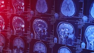 Imagen cerebral